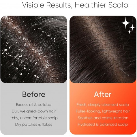  Sonic Vibrating Scalp Massager Shampoo Brush: Electric Silicone Hair Scrubber for Deep Scalp Clean, Dandruff Removal, Exfoliation, Stress Relief & Hair Growth –Suitable for Women, Men, Kids & Pets